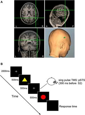 Transcranial Magnetic Stimulation Over the Right Posterior Superior Temporal Sulcus Promotes the Feature Discrimination Processing
